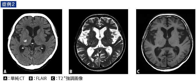 頭部CT・MRIの撮像・読影マスター – 日本医事新報社
